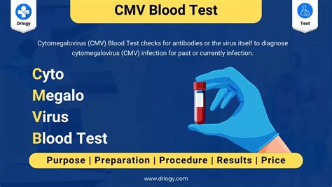 cmv pcr blood test bottle|cmv lab test.